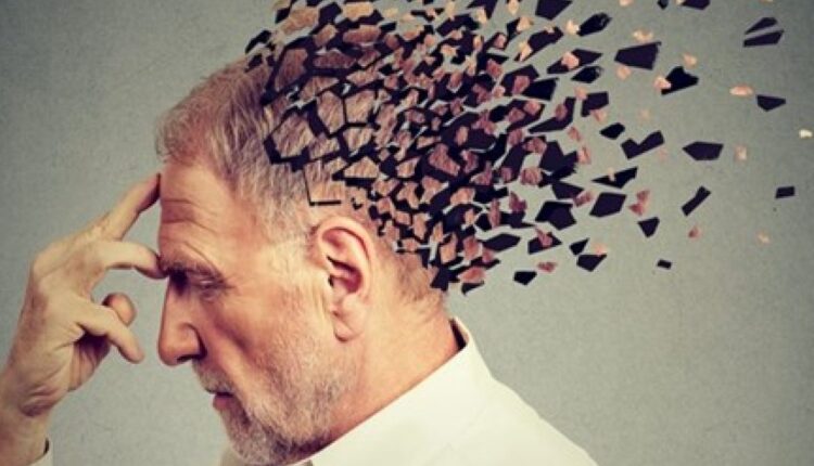 Alzheimer